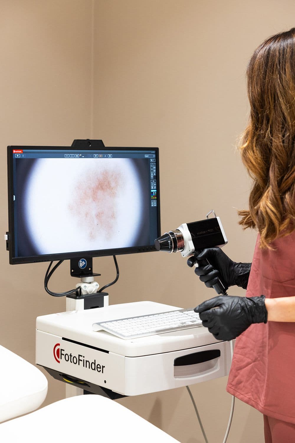Visita tricologica con dermatoscopia digitale FotoFinder® Vexia per la diagnosi di caduta capelli presso Studio Aimi a Parma