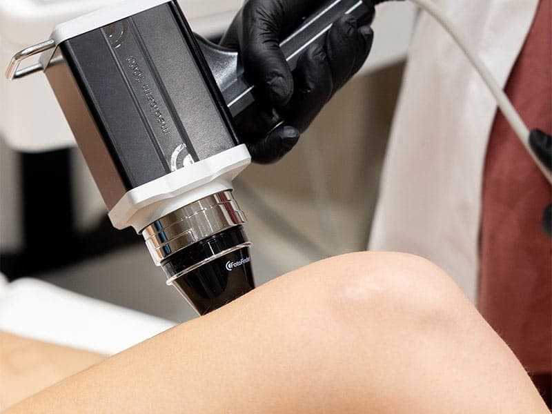 Dermatologia digitale con FotoFinder® Vexia per mappatura dei nei e prevenzione del melanoma presso Studio Aimi a Parma