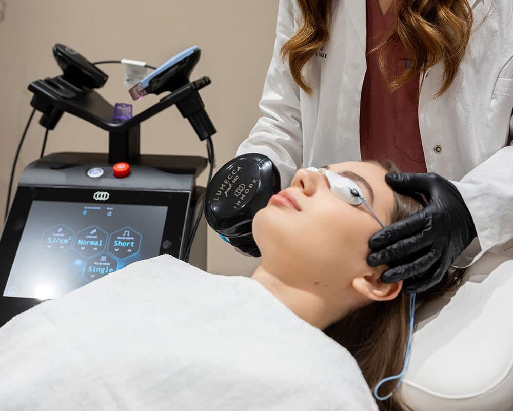 Trattamento di laserterapia dermatologica su viso e corpo presso Studio Aimi a Parma per macchie, capillari e imperfezioni cutanee